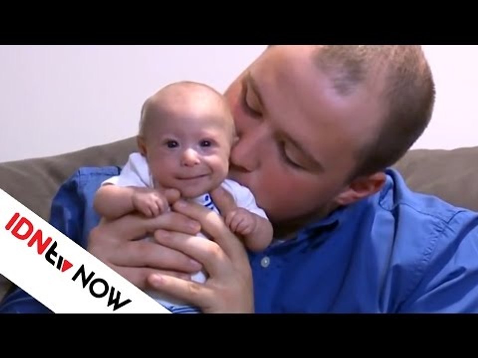 Dilahirkan dengan Penyakit Langka, Bayi Ini Berukuran Kecil Meskipun Sudah 7 Bulan | IDNtv NOW
