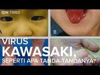 Virus Kawasaki, Seperti Apa Tanda-Tandanya?