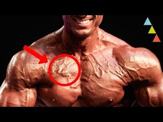 ¿Cómo afecta el dopaje en el cuerpo de un deportista?