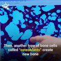 Osteoporosis causes bones to become weak and brittle