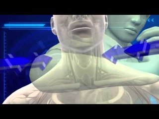 Next Media Video: Eric Garner case — Why a chokehold can kill