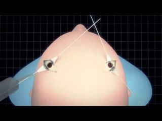 Argentina's President Cristina Kirchner's brain condition explained