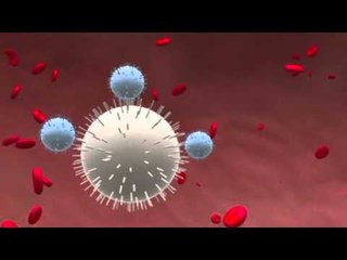 Killer nanoparticles may stop cancer from spreading