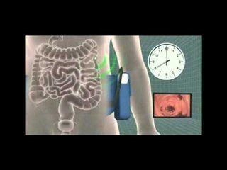 Next Media: NeFDA approves swallowable Pillcam to detect colon cancer