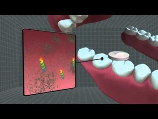 Next Media: Pentagon develops cavity-fighting combat gum for soldiers to avoid dental emergencies