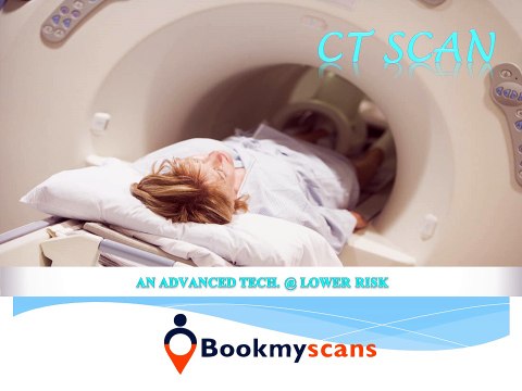 Important facts, procedure & real cost of CT Scan you should be aware of.