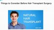 Things to Consider Before Hair Transplant Surgery (1)