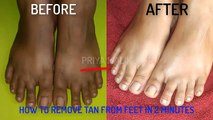 HOW TO REMOVE SUN TAN FROM FEET