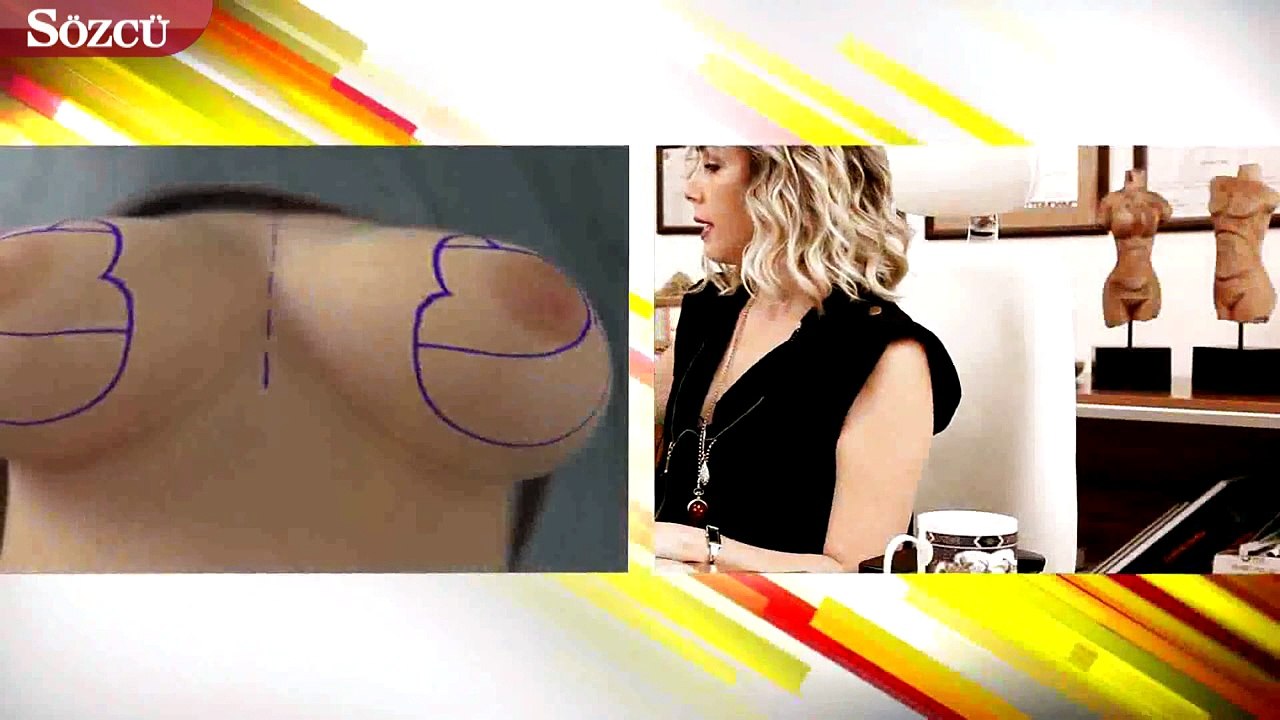 Meme küçültme ameliyatı nasıl yapılır