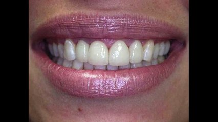 Best Cosmetic Dentist NYC