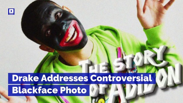 Drake Addresses Controversial Blackface Photo