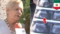 Pregnant 71-year-old woman soon become the world's oldest mom