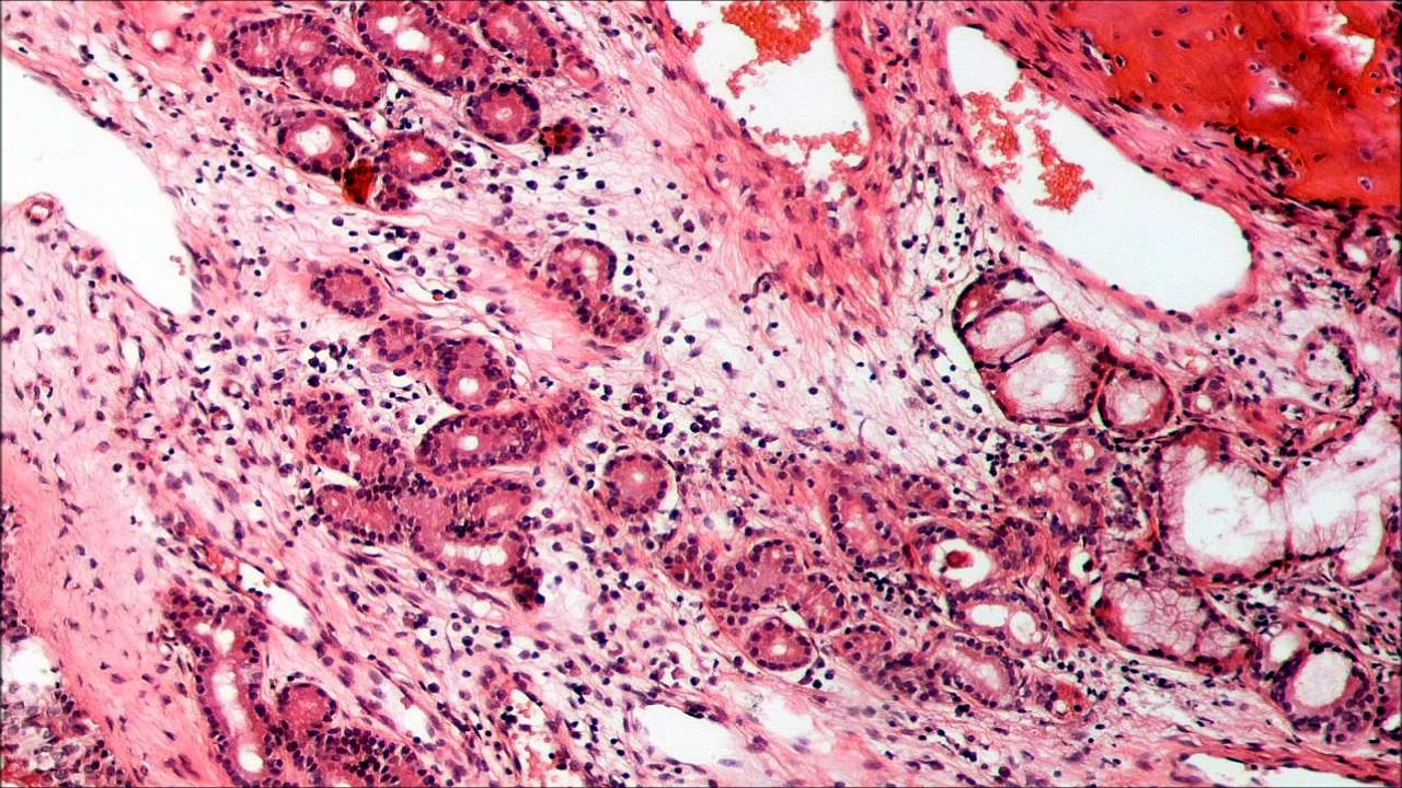 Klangtherapie bei Allergien oder Sinusitis (787 Hz) - 30 Minuten