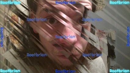 Week's long of zit popping attempts ending in agonish, utter painful fails, some successes and oozes