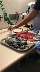 Poumon sain VS poumon de fumeur