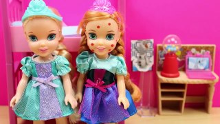 Anna tiene la varicela y va a la consulta de Barbie Doctora | Aventuras de Elsa y Anna FROZEN