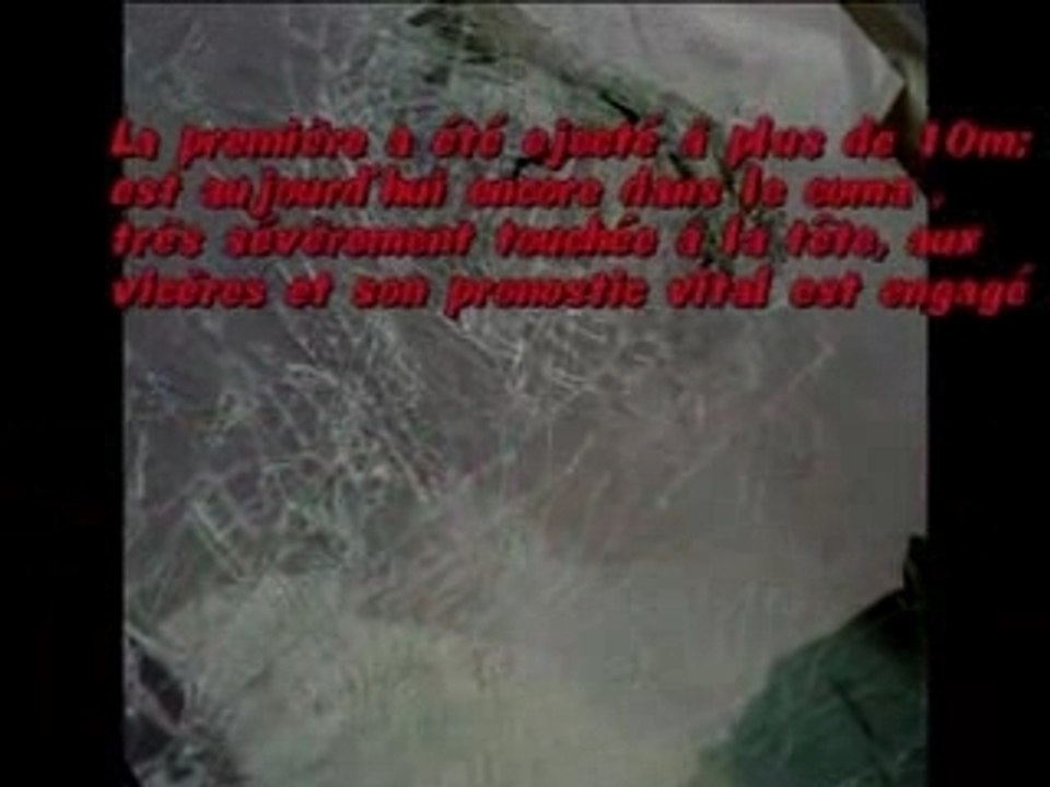 Video Accident Police Toulouse - toulouse, villiers, le, bel