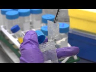 New 'wonder plaster' that can save the life of young burns victims