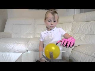 Girl gets super-hero themed prosthetic hand