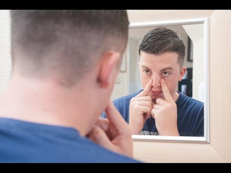 A 21-year-old told how he is back on the straight and narrow after fixing botched nose job