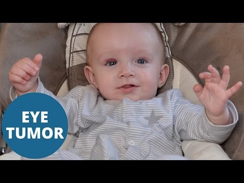 Baby's sight saved by American medics after NHS refused to operate