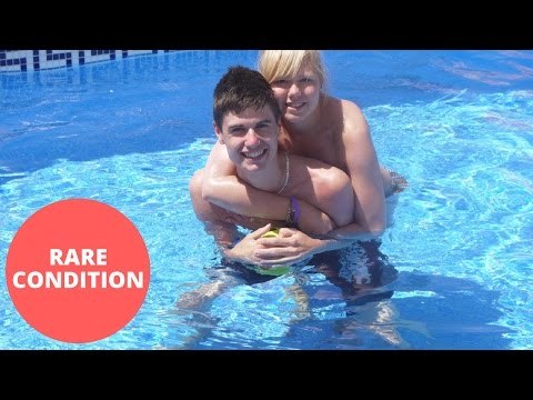 Woman suffers rare condition which sees her joints dislocate 60 times a day