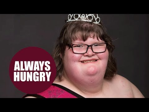 Meet the girl who is CONSTANTLY HUNGRY