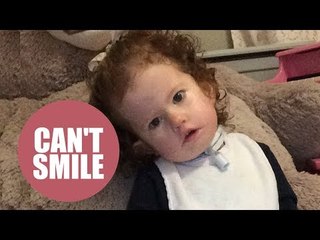 Surgery offers hope to family of little girl who has NEVER smiled because of rare syndrome