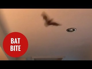 Girl needed emergency rabies injection after bit by a BAT