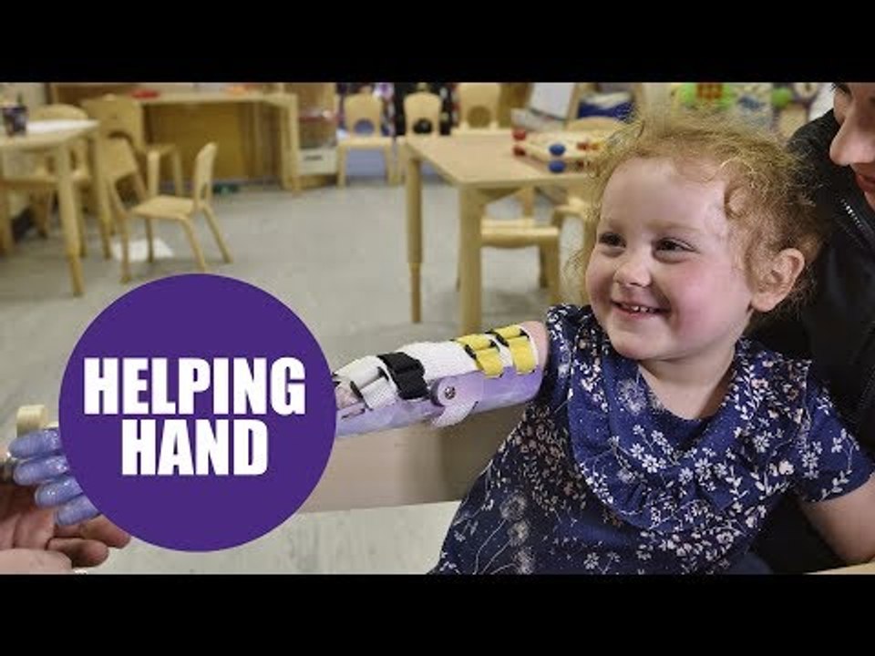 Girl given a new 'bionic' arm after she was born with part of her arm missing