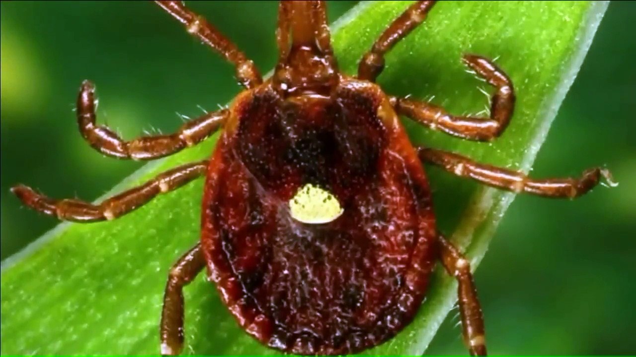 Teen Develops Allergy to Meat After Tick Bite