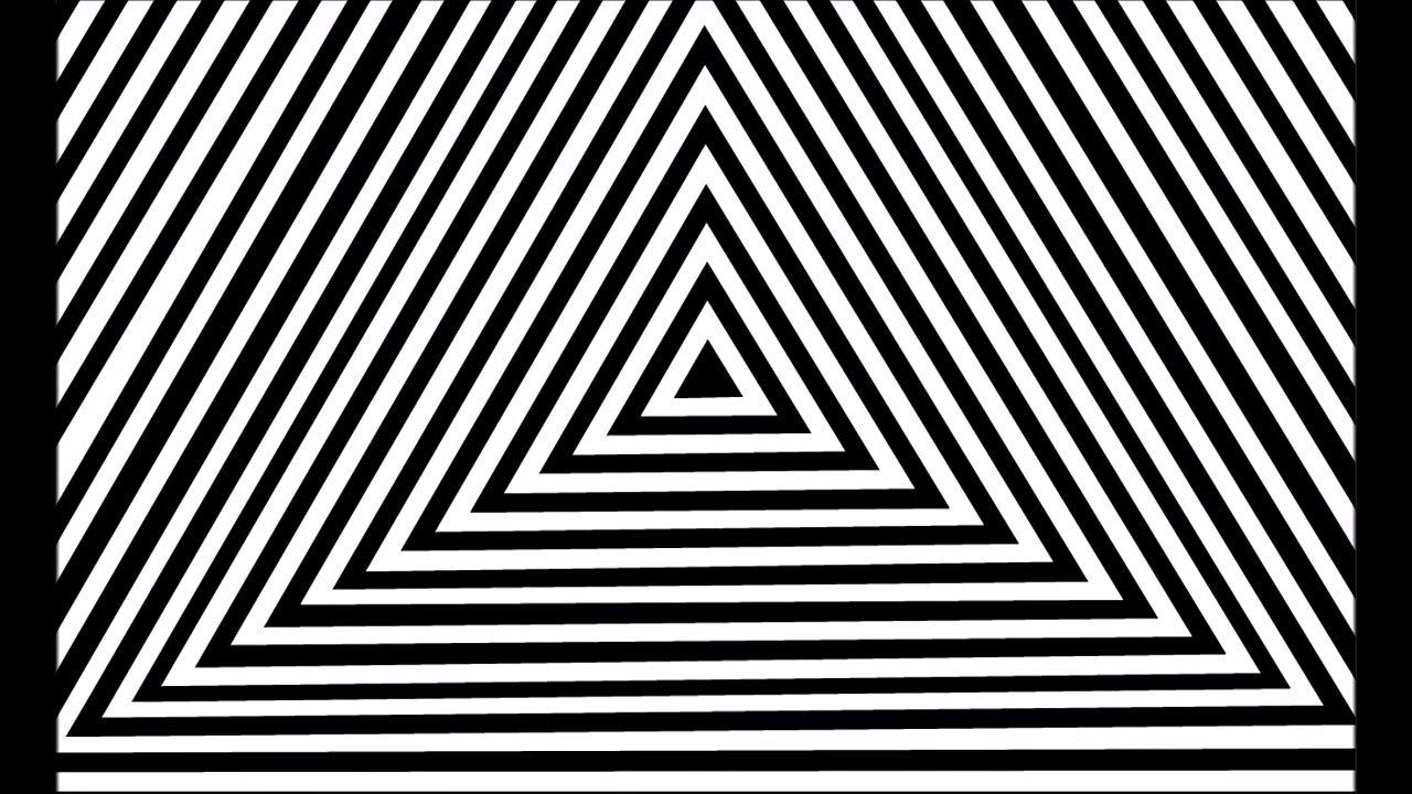 lazy eyes treatment and exercises (Amblyopia) 弱視治療及訓練