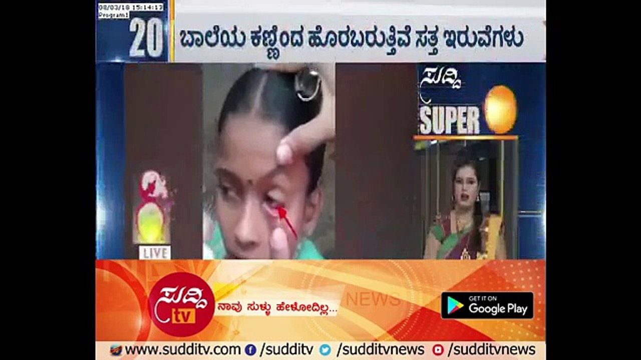 Belthangady___Dead_Ants_Coming_Out_Of_Girls_Eye___ಸುದ್ದಿ_ಟಿವಿ
