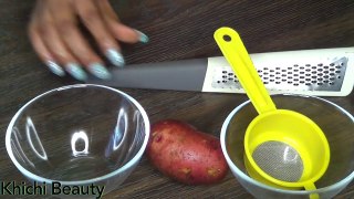 HOW TO USE POTATO TO GET RID OF DARK UNDER EYES CIRCLES | DOES IT WORK | Khichi Beauty