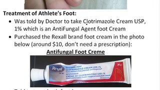 Athletes Foot: What is it, how to treat it and how to avoid it! A must watch!