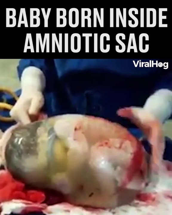 One in every 80,000 babies is an en-caul birth...amazing! 