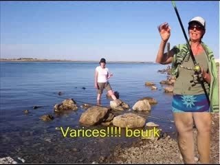 MES VARICES