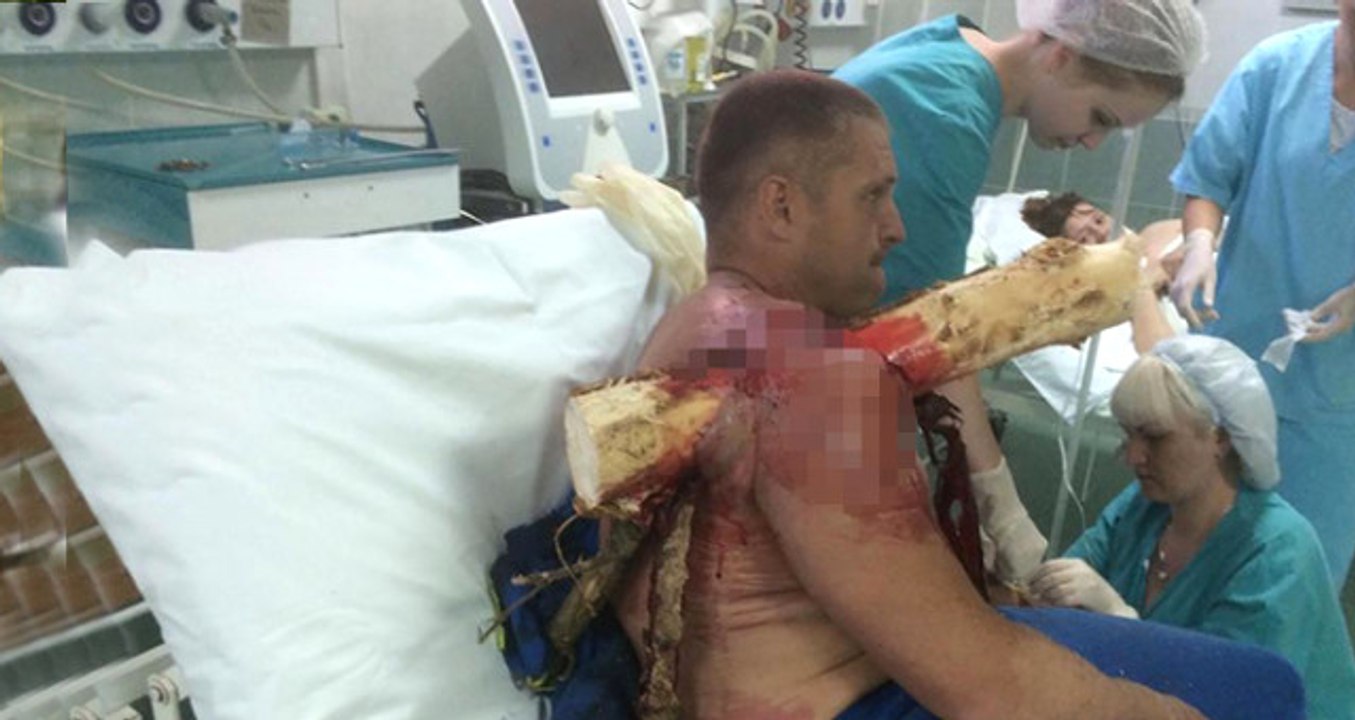 Yamaç Paraşütü Yaparken Ormanlık Alana Çakıldı, Omzuna Devasa Bir Ağaç Dalı Saplandı