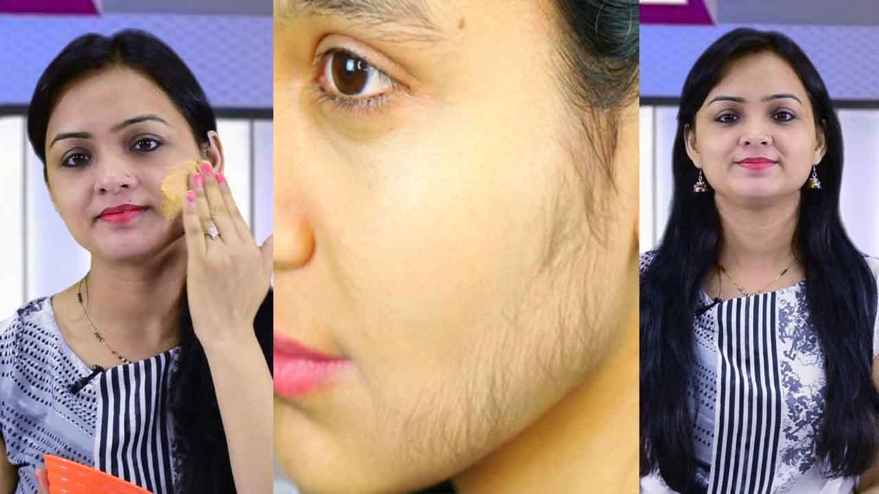 Facial Hair Removal Pack at Home: इस आसान तरीके से घर बैठे अनचाहे बालों से पाएं छुटकारा  | Boldsky