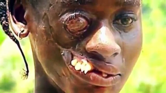 Самые СТРАШНЫЕ БОЛЕЗНИ в мире!