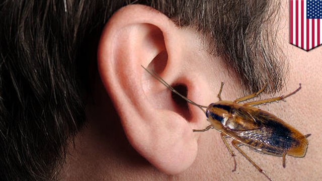 Dying cockroach leaves egg in Florida man's ear