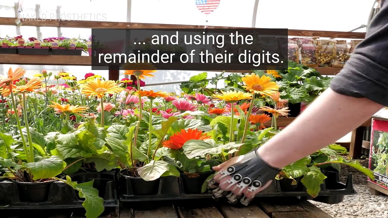 How These Prosthetics Make Everyday Tasks Easier