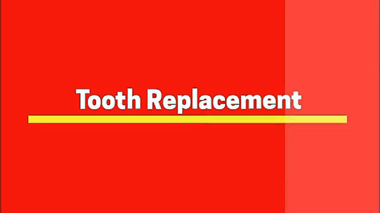 Affordable Tooth Replacement options in Dubai