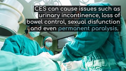 How Rare is Cauda Equina Syndrome