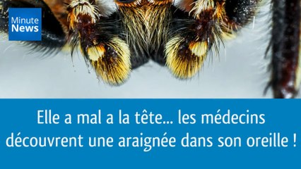 Elle a mal à la tête... Les médecins découvrent une araignée dans son oreille !