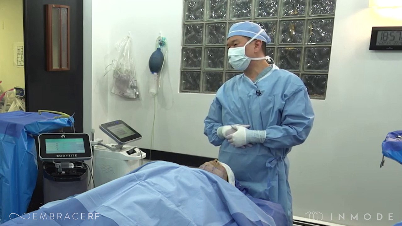 EmbraceRF Facial Rejuvenation Procedure