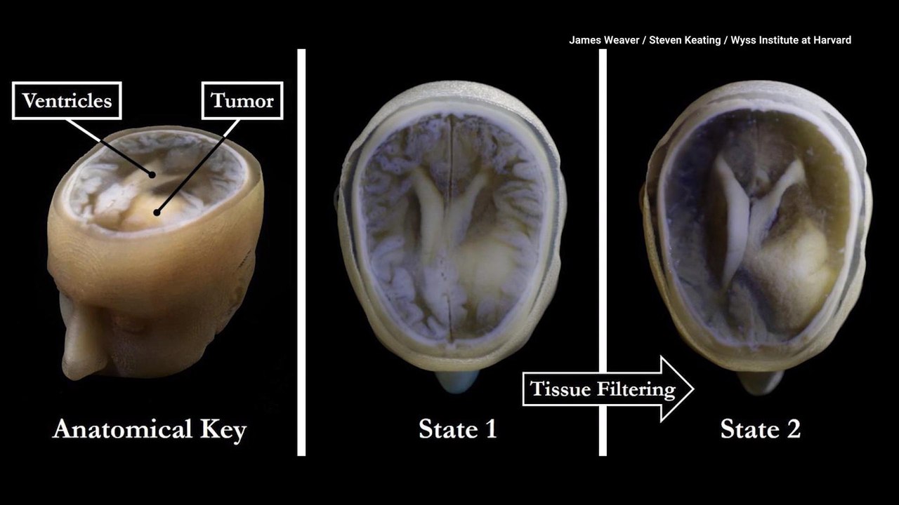 You Could Soon Get a 3D Printed Model of Your B...