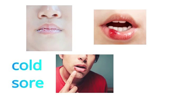 Easy Ways to Cure Chapped Lips in Minutes