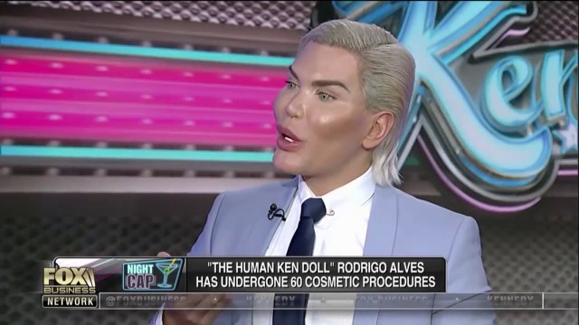 Il subit 60 opérations de chirurgie esthétique pour ressembler à la poupée Ken