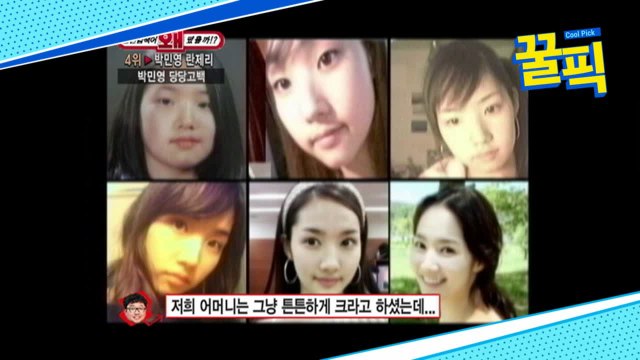′김비서가 왜 그럴까′ 박민영, 과거 당당 성형 고백★ (ft.가인-이시영-유이)